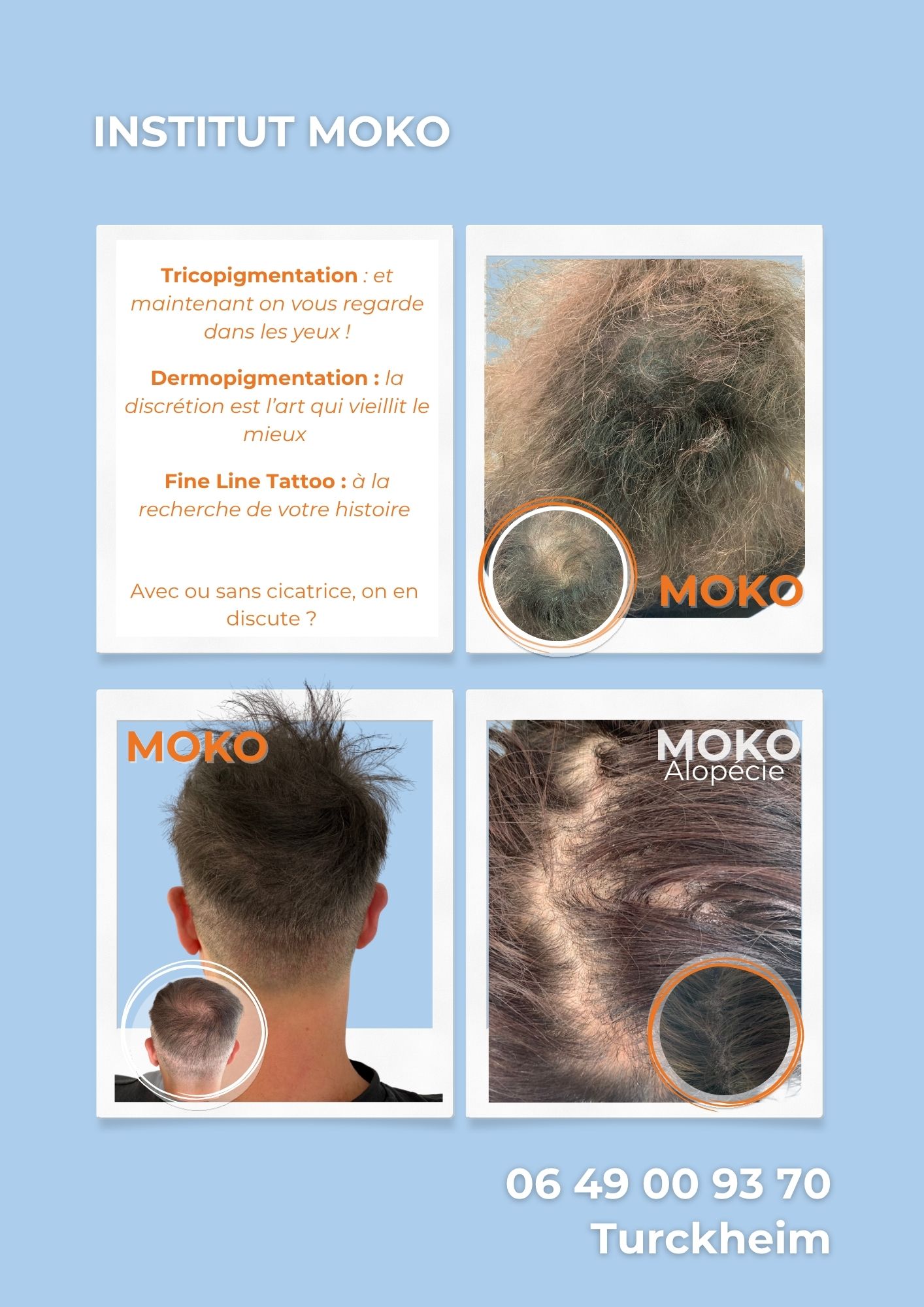 Tricopigmentation densité · Institut Moko, Turckheim (Colmar), Alsace