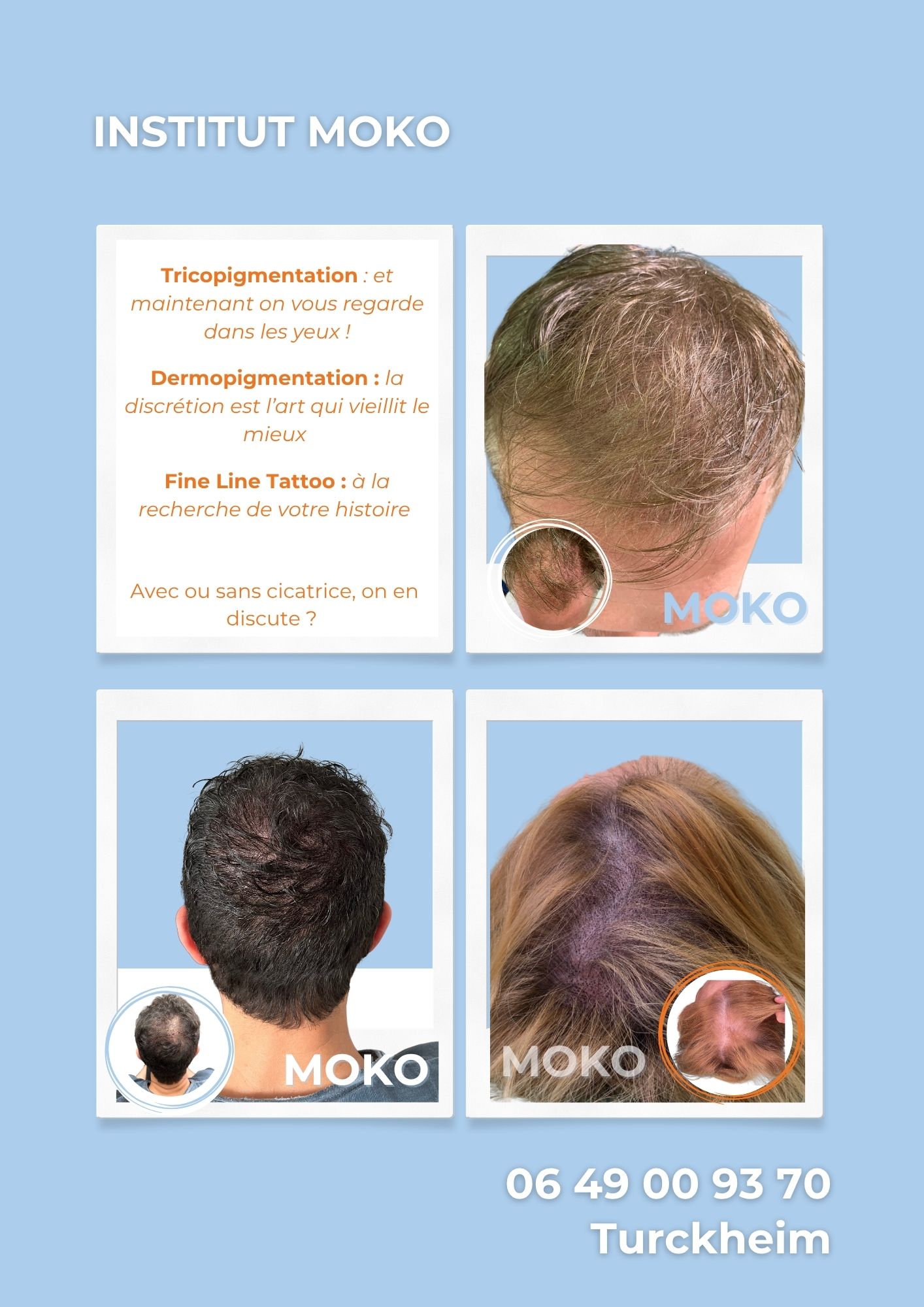 Tricopigmentation densité · Institut Moko, Turckheim (Colmar), Alsace