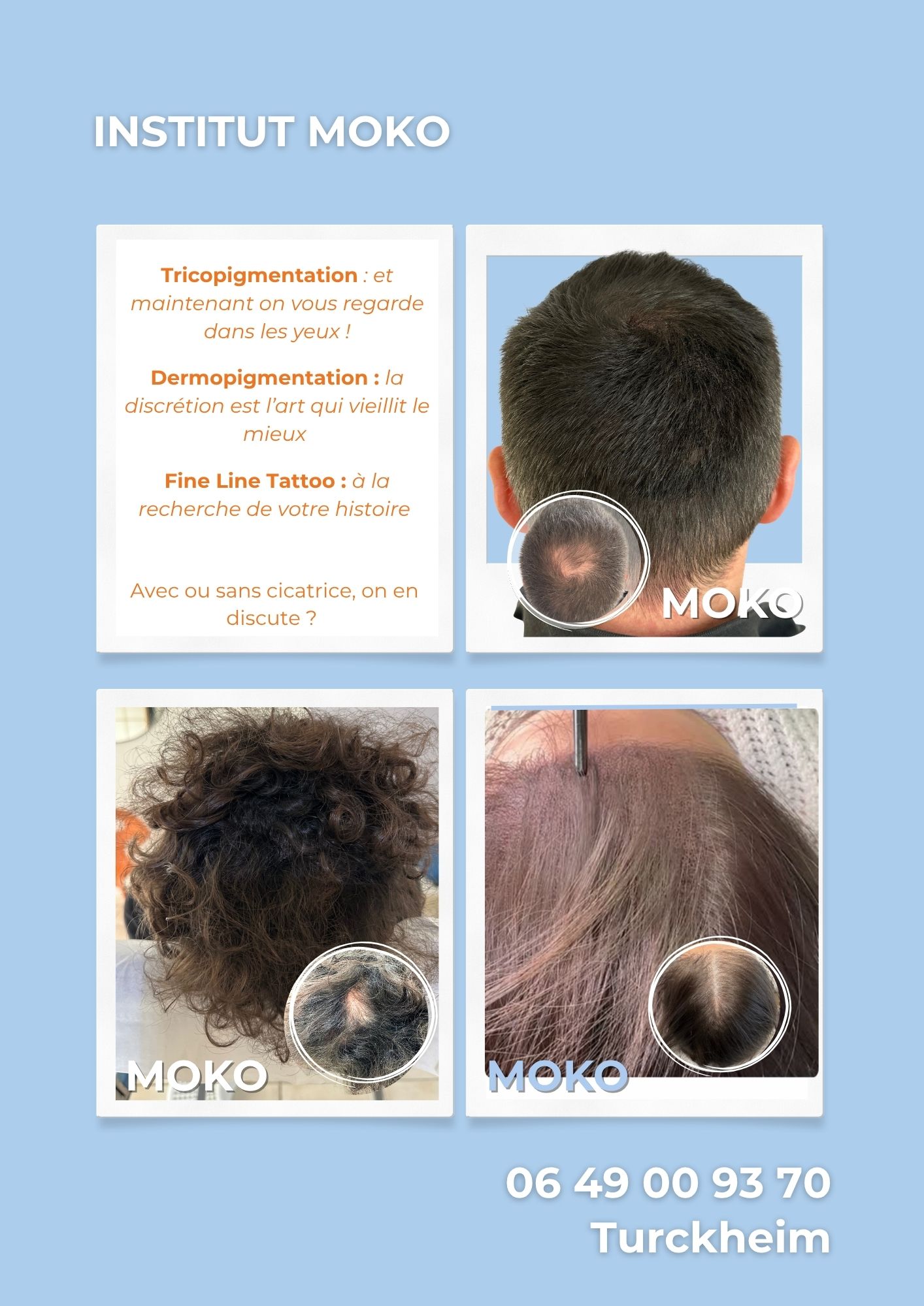 Tricopigmentation densité · Institut Moko, Turckheim (Colmar), Alsace