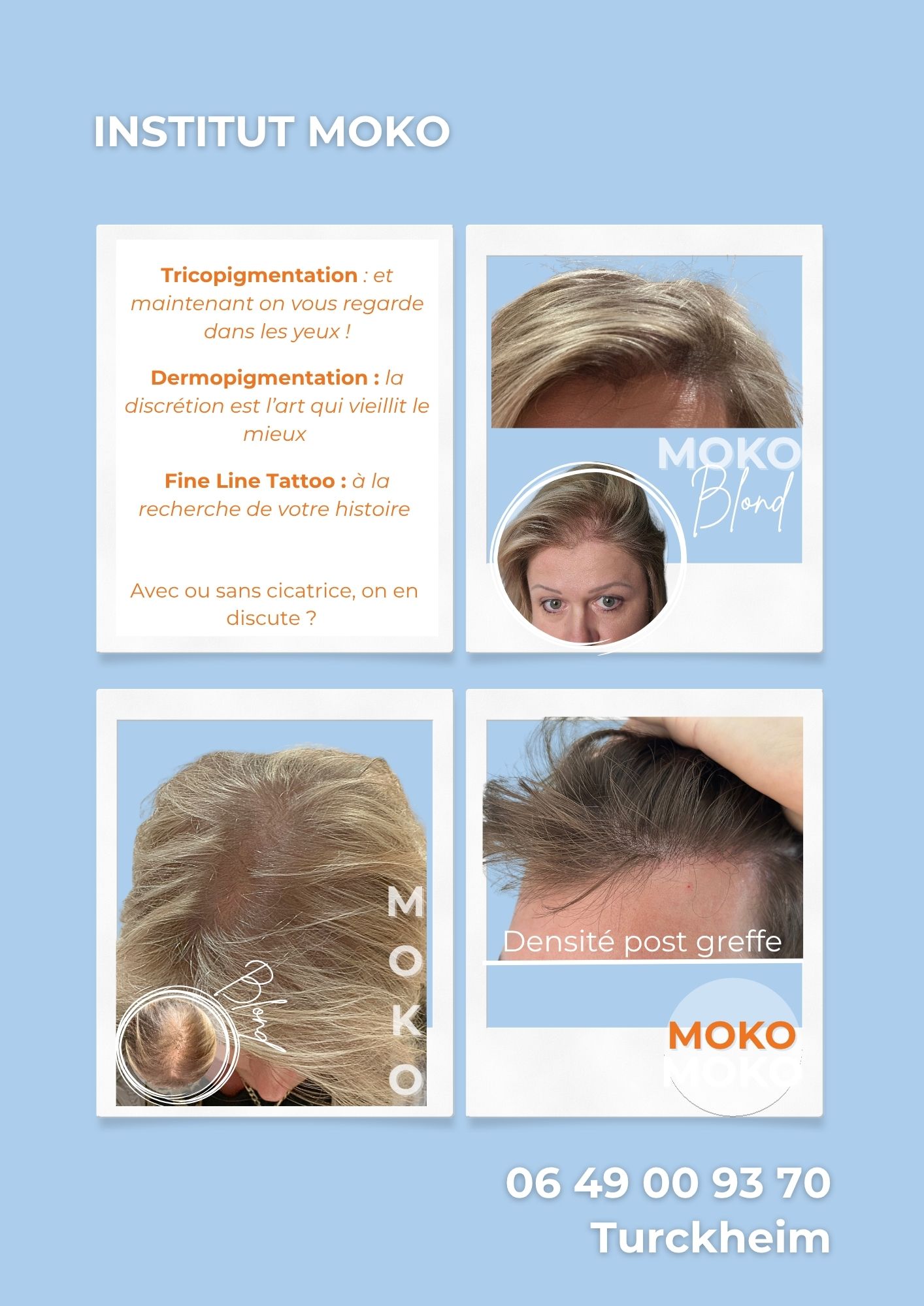 Tricopigmentation densité · Institut Moko, Turckheim (Colmar), Alsace