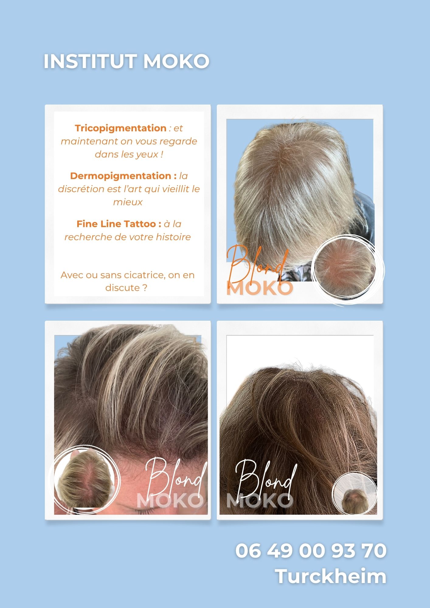 Tricopigmentation densité · Institut Moko, Turckheim (Colmar), Alsace