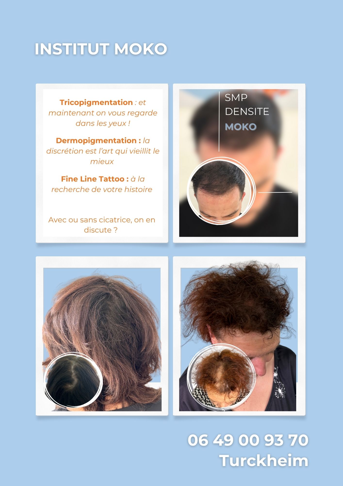 Tricopigmentation densité · Institut Moko, Turckheim (Colmar), Alsace