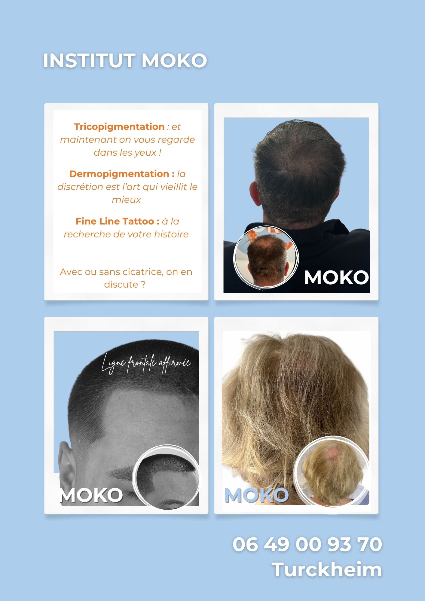 Tricopigmentation densité · Institut Moko, Turckheim (Colmar), Alsace