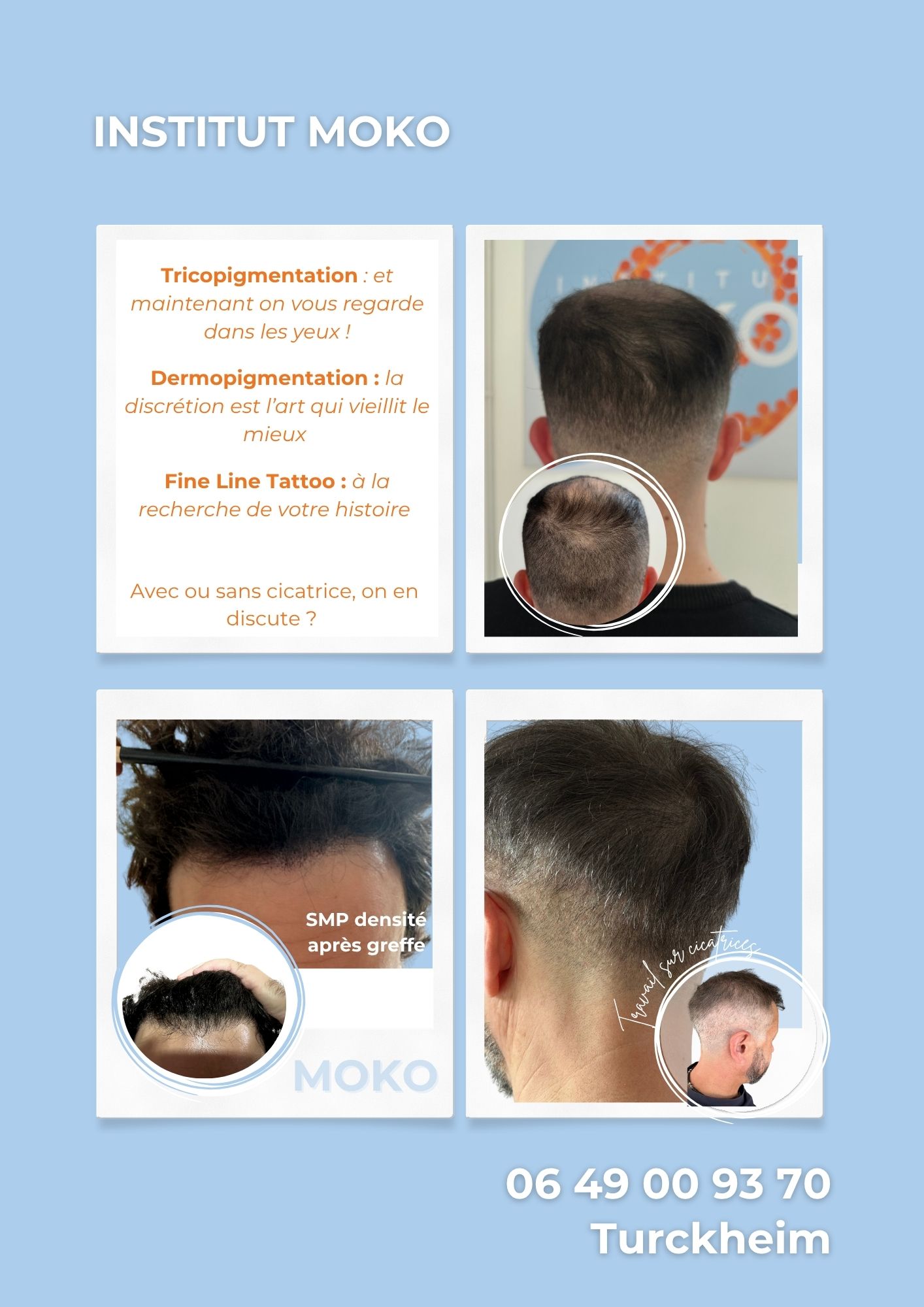 Tricopigmentation densité · Institut Moko, Turckheim (Colmar), Alsace