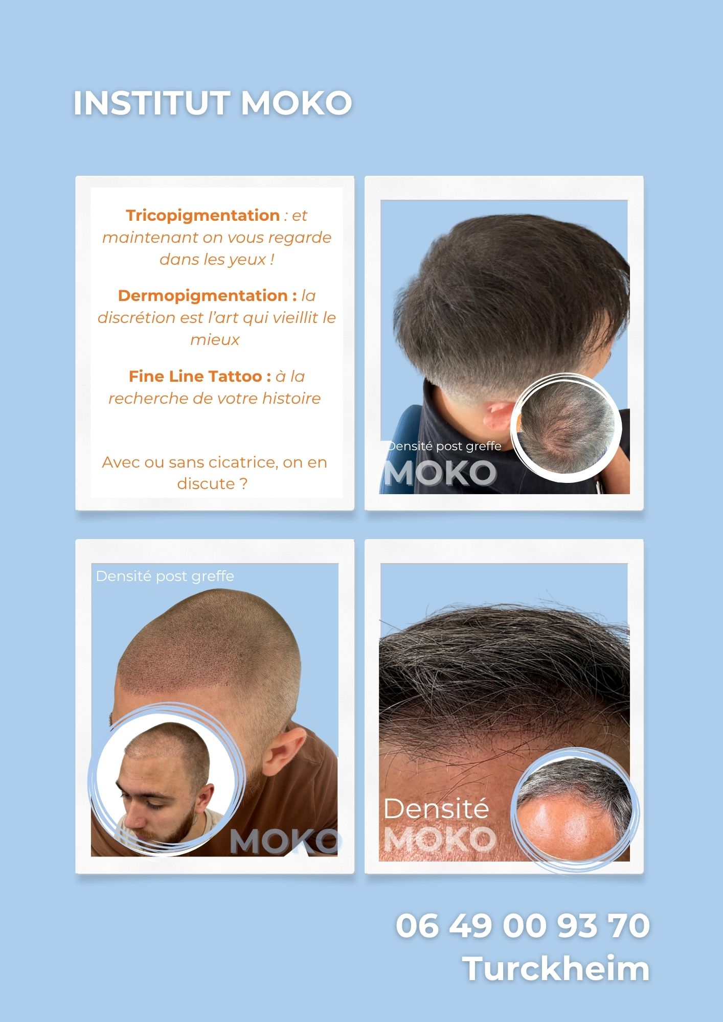 Tricopigmentation densité · Institut Moko, Turckheim (Colmar), Alsace