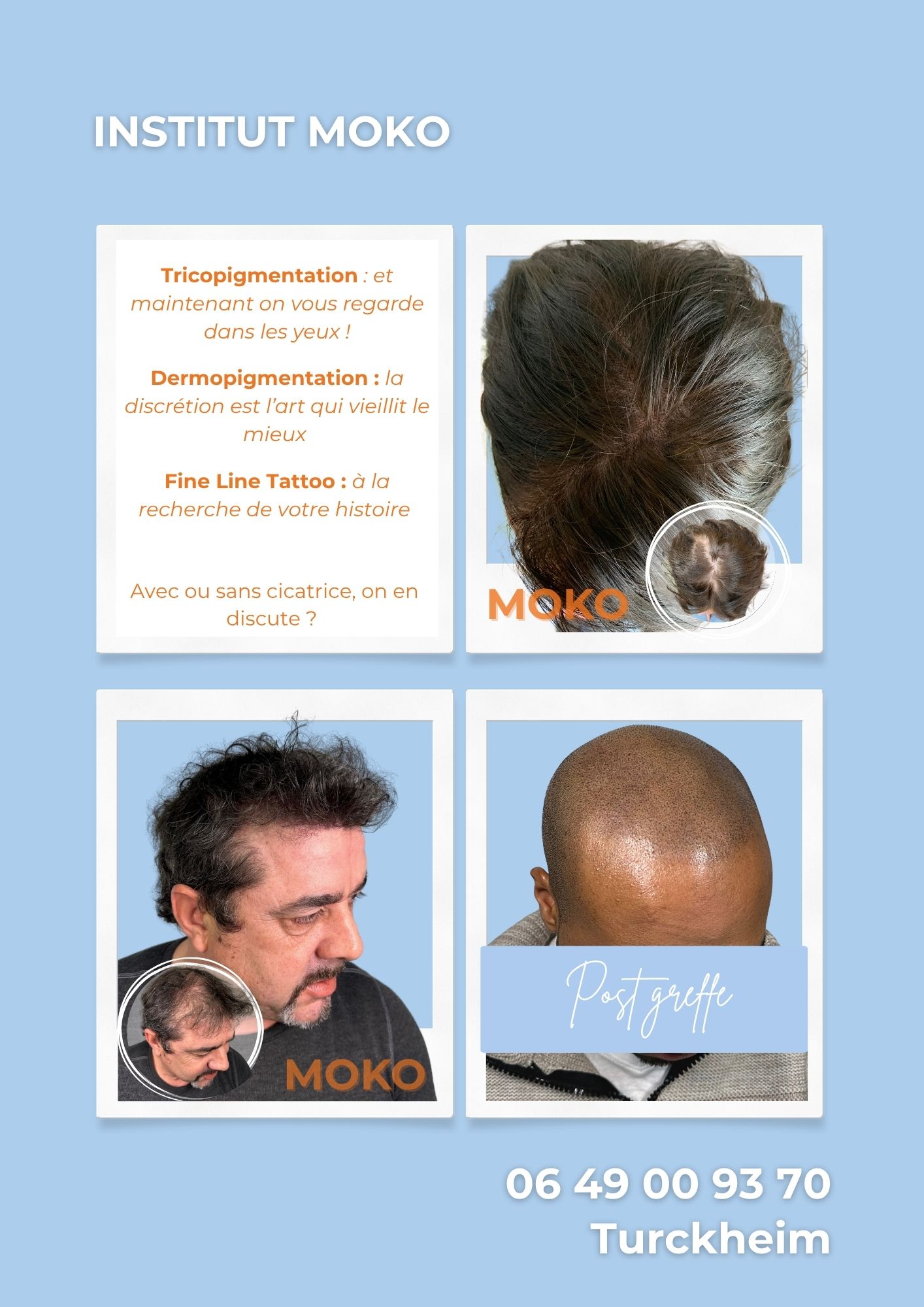 Tricopigmentation densité · Institut Moko, Turckheim (Colmar), Alsace