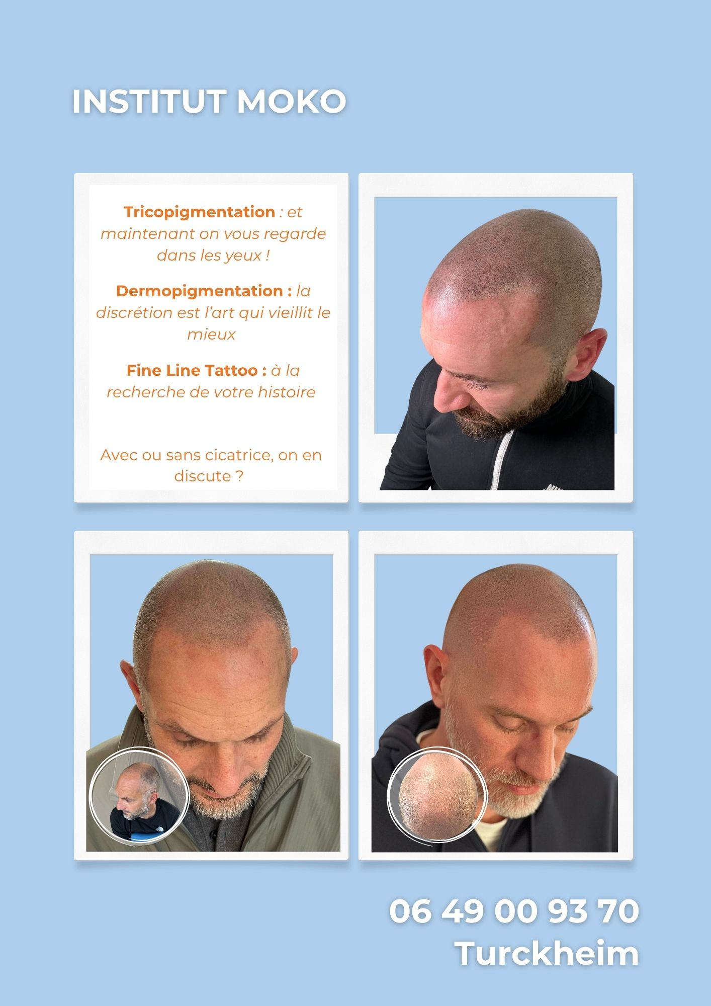 Tricopigmentation effet crâne rasé · Institut Moko, Turckheim (Colmar), Alsace