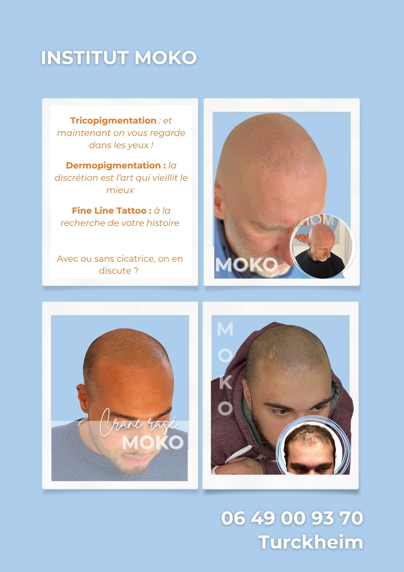 Tricopigmentation effet crâne rasé · Institut Moko, Turckheim (Colmar), Alsace