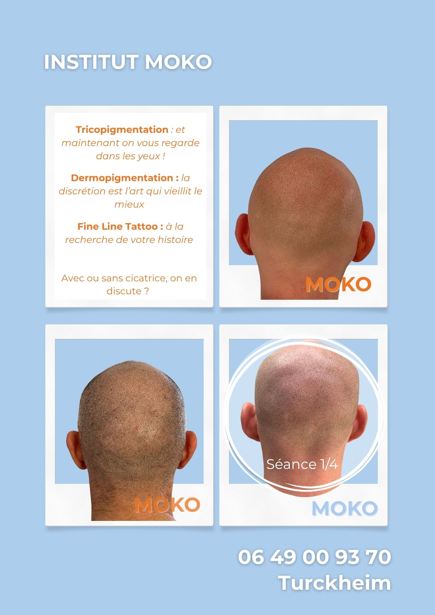 Tricopigmentation effet crâne rasé · Institut Moko, Turckheim (Colmar), Alsace