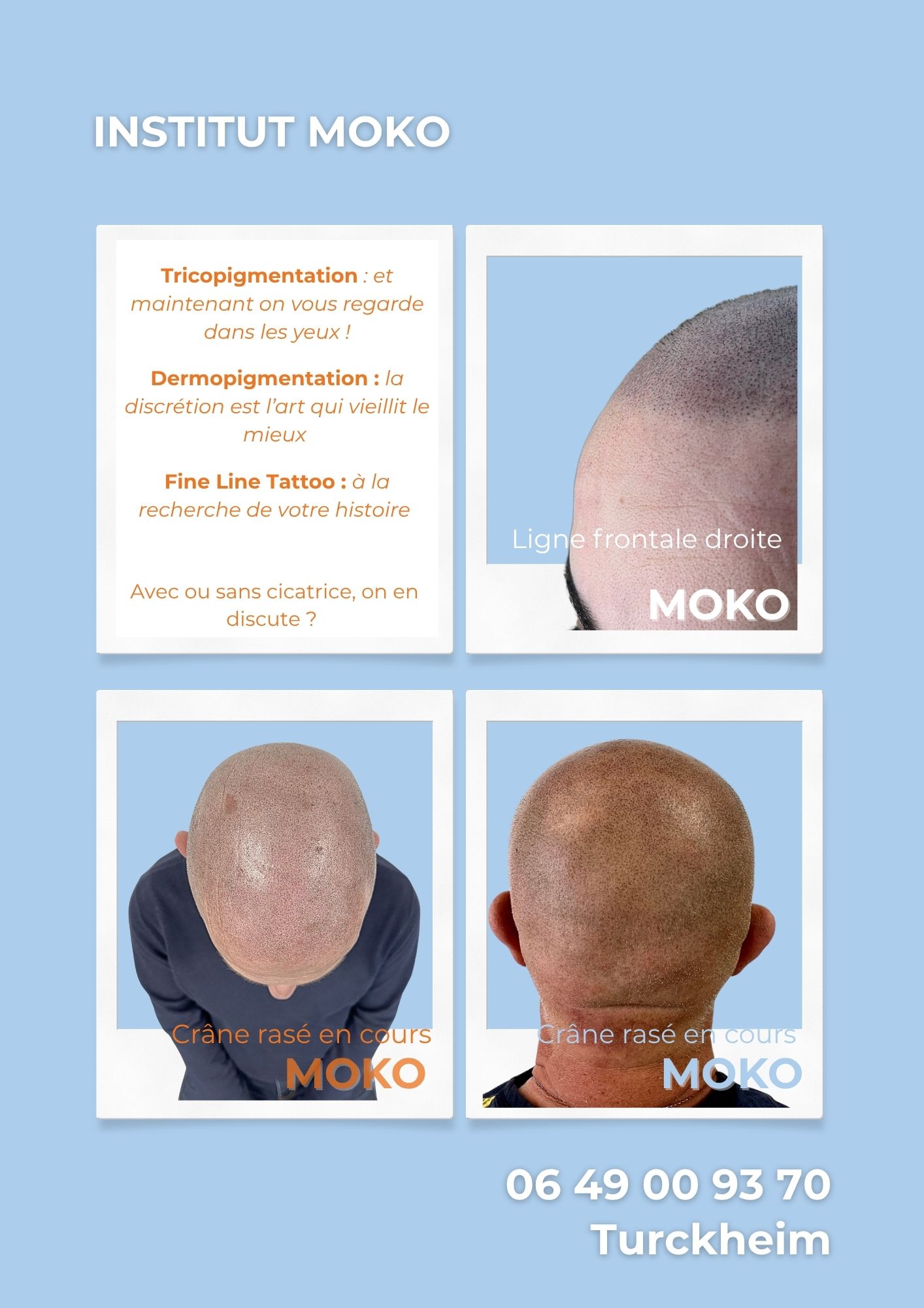 Tricopigmentation effet crâne rasé · Institut Moko, Turckheim (Colmar), Alsace